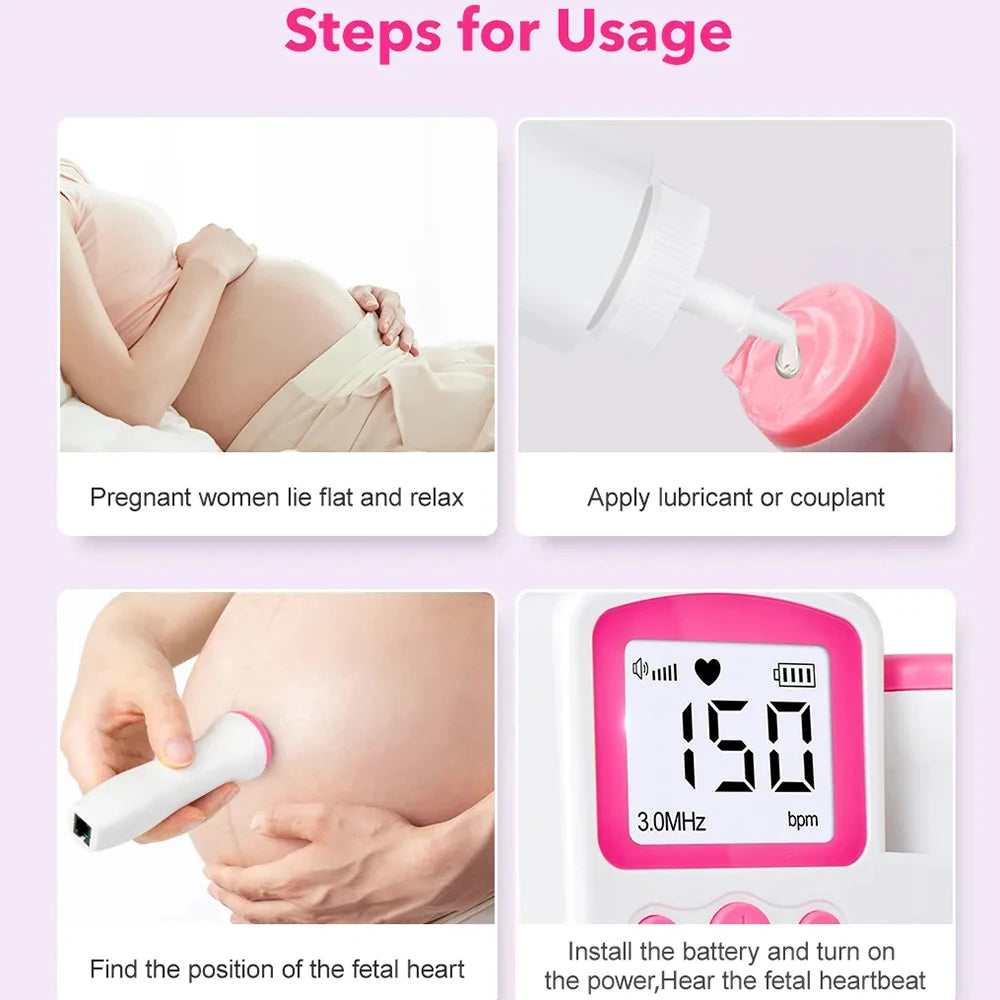 Doppler Fetal Digital – Escucha los latidos del corazón de tu bebé desde el principio del embarazo | Monitor de frecuencia cardíaca por ultrasonido